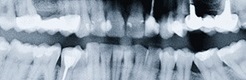 endodoncie246x80.jpg