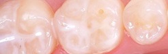 peceteni-zubu246x80.jpg